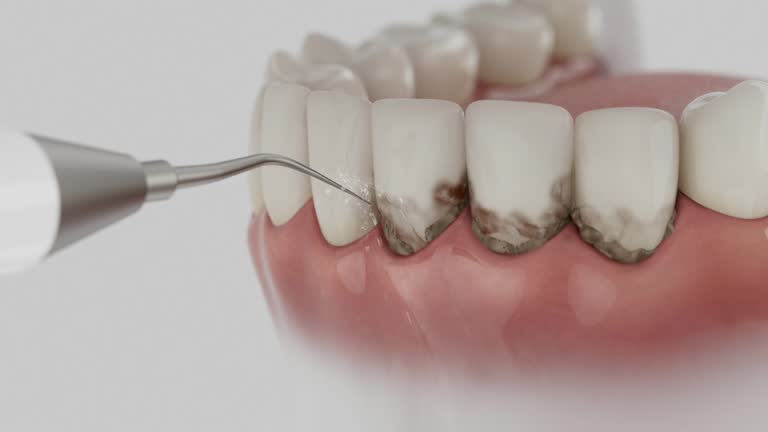Reliable Emergency Dentist contractor in Bourbon, MO by Smile Center Dentistry